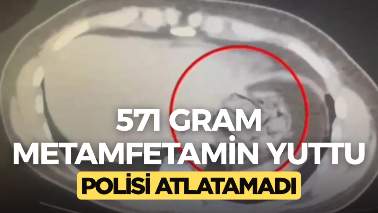 Kars'ta yutulan 571 gram metamfetamin polise takıldı